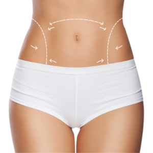PACK CORPORAL REMODELANTE